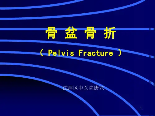 骨盆骨折ppt