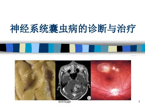 神经系统囊虫病的诊断和治疗