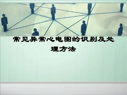 常见异常心电图的识别及处理精品PPT课件