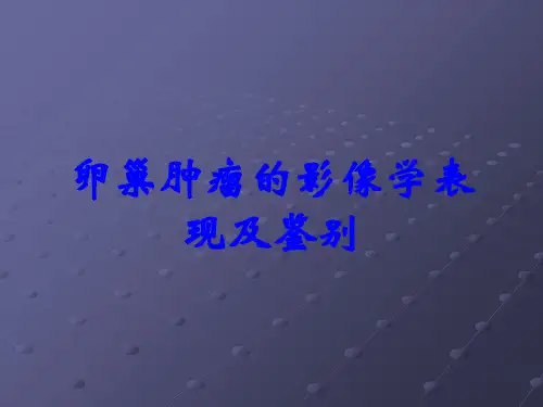 卵巢肿瘤的影像学表现及鉴别