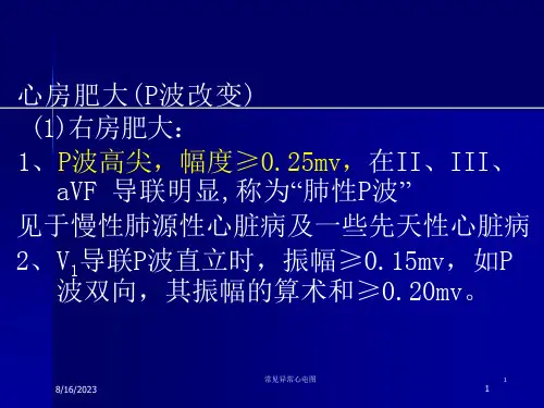 常见异常心电图ppt课件