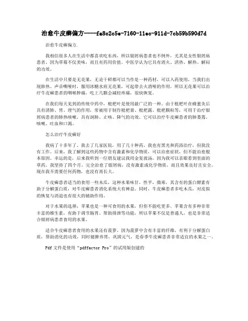 治愈牛皮癣偏方