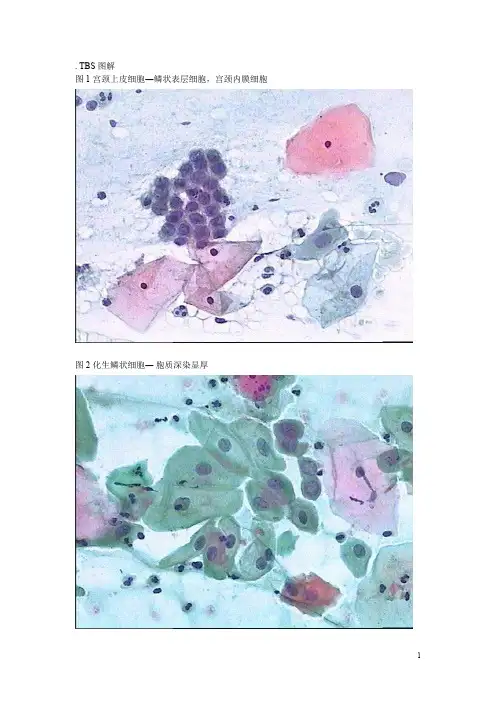 TBS图解——精选推荐