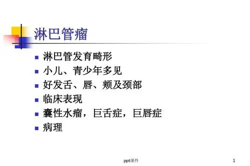 口腔组织病理学--淋巴管瘤  ppt课件