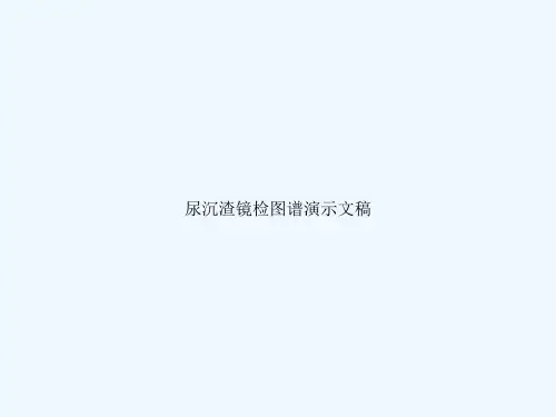 尿沉渣镜检图谱演示文稿