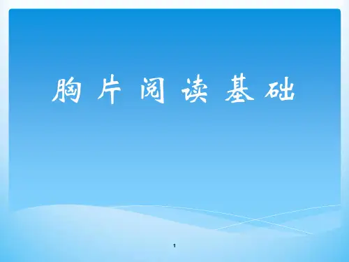 胸片阅读ppt课件