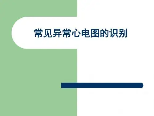 常见异常心电图-PPT课件