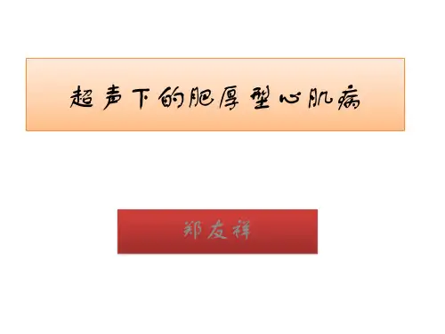肥厚型心肌病
