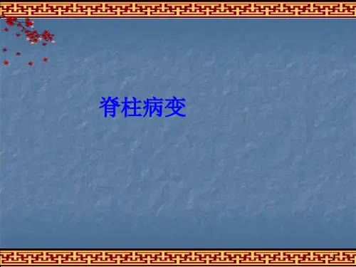 脊柱病变ppt课件