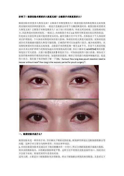 好奇了!眼袋切除术需要多久恢复无痕？去眼袋手术恢复期多久？
