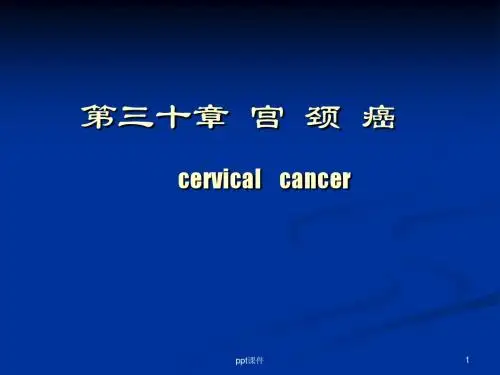 宫颈癌  ppt课件