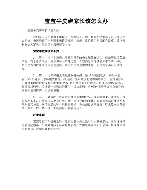 宝宝牛皮癣家长该怎么办