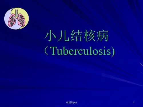 小儿结核病ppt课件