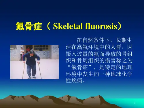 氟骨症的临床表现及诊断PPT课件