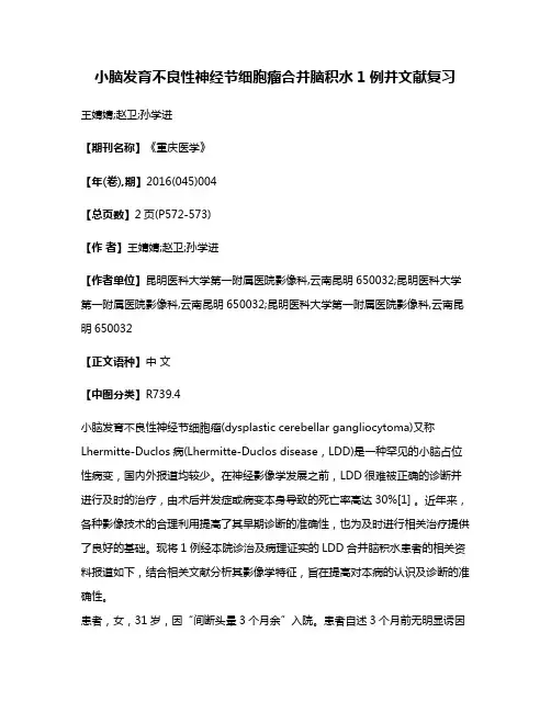 小脑发育不良性神经节细胞瘤合并脑积水1例并文献复习
