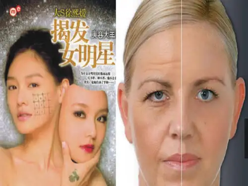 热玛吉培训资料课件