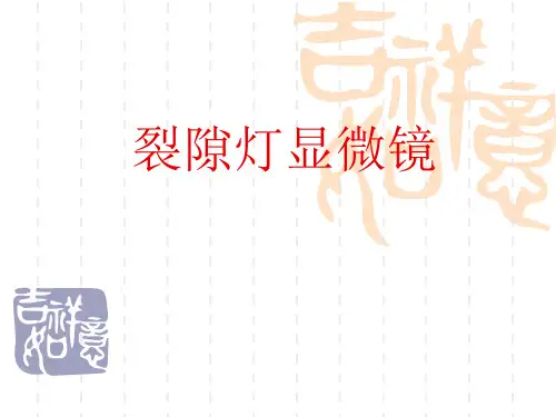 裂隙灯检查