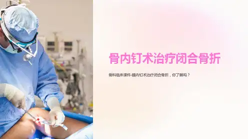《骨科临床课件-髓内钉术治疗闭合骨折》