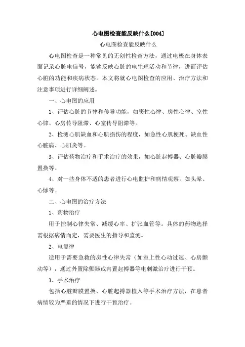 心电图检查能反映什么[004]