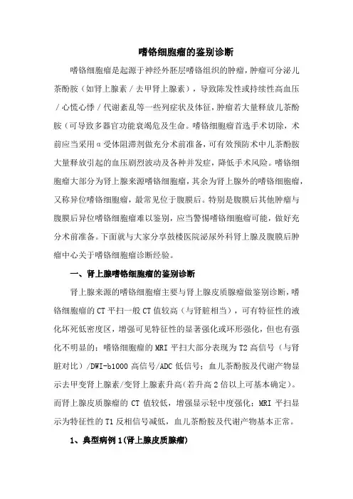 嗜铬细胞瘤的鉴别诊断
