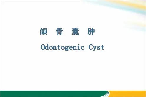 颌骨囊肿课件