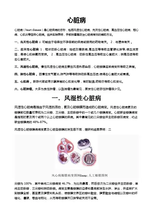先天性心脏病