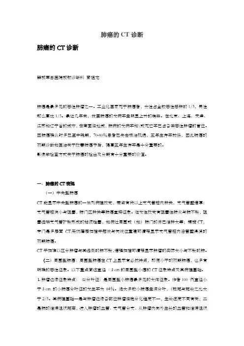 肺癌的CT诊断