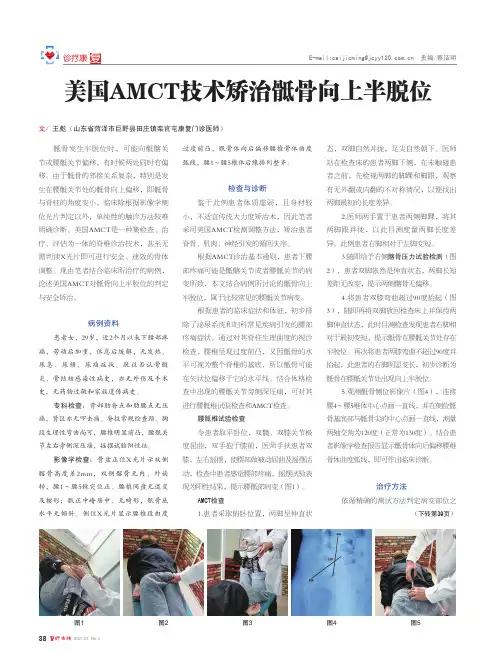 美国AMCT技术矫治骶骨向上半脱位