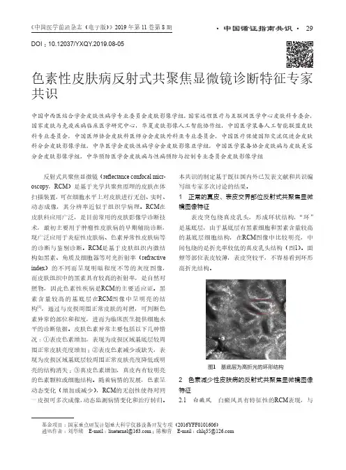 色素性皮肤病反射式共聚焦显微镜诊断特征专家共识