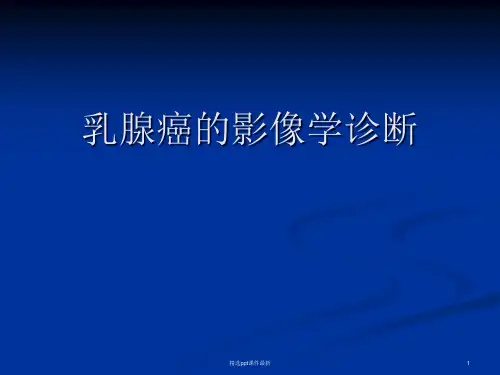 乳腺癌的影像学诊断PPT课件