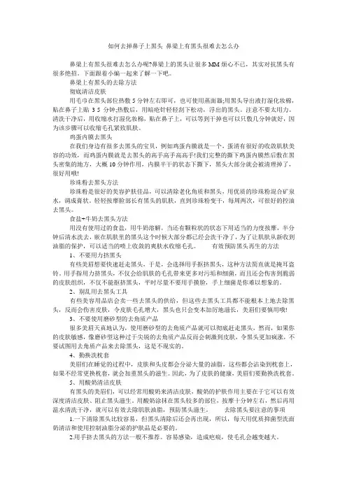 如何去掉鼻子上黑头 鼻梁上有黑头很难去怎么办