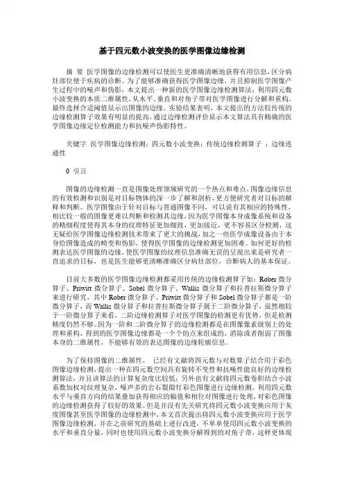基于四元数小波变换的医学图像边缘检测
