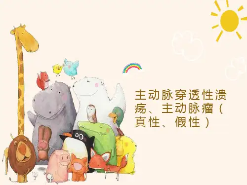 主动脉穿透性溃疡和主动脉瘤的影像表现