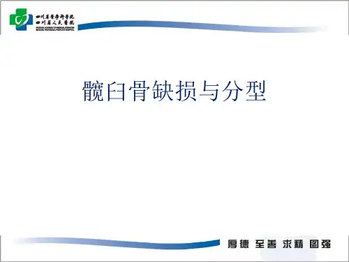 髋臼骨缺损分型