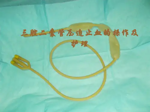 三腔二囊管压迫止血的操作及护理