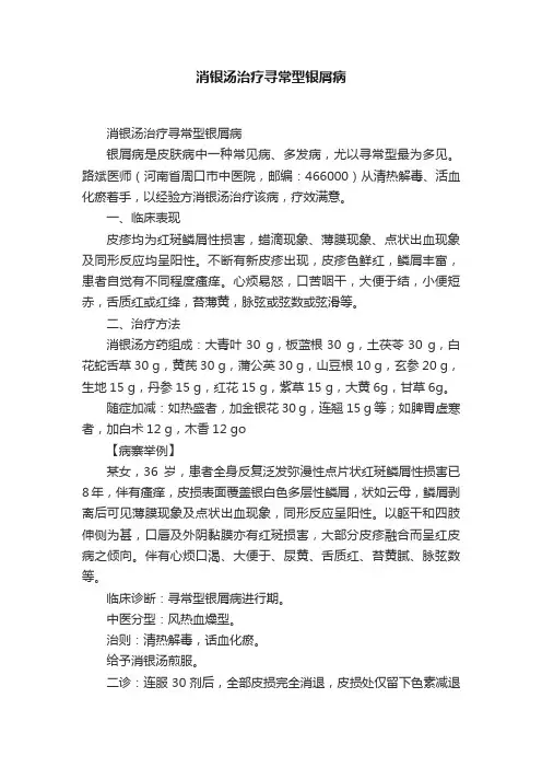 消银汤治疗寻常型银屑病
