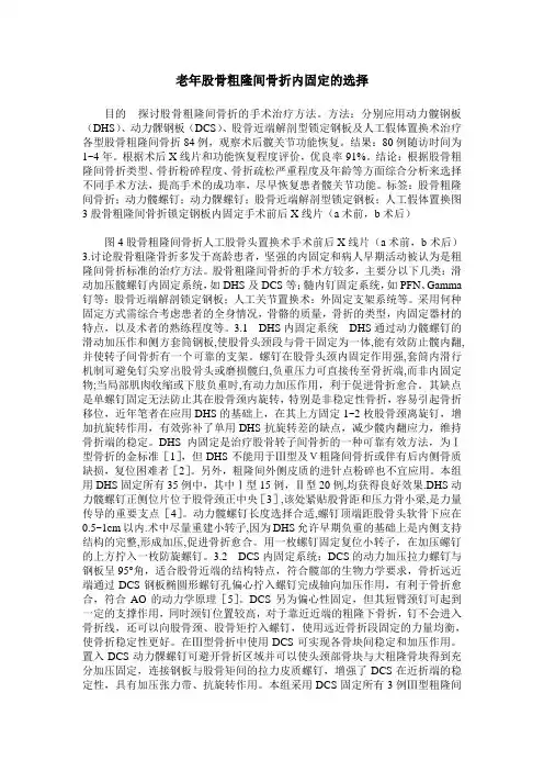 老年股骨粗隆间骨折内固定的选择