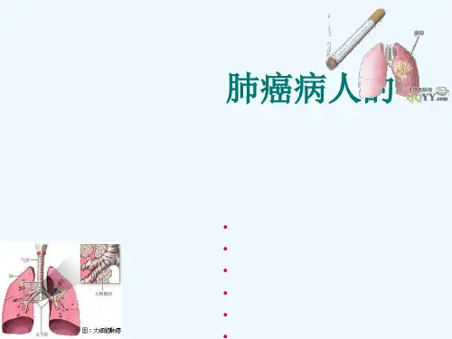 肺癌患者护理查房