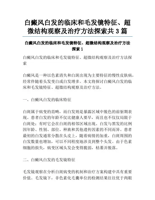 白癜风白发的临床和毛发镜特征、超微结构观察及治疗方法探索共3篇