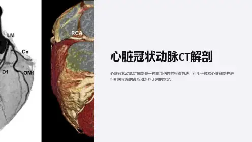 心脏冠状动脉CT解剖