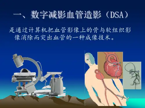 DSA设备及成像原理