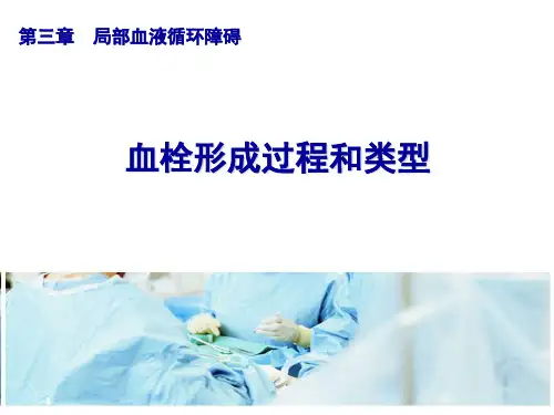 血栓形成过程和类型.ppt