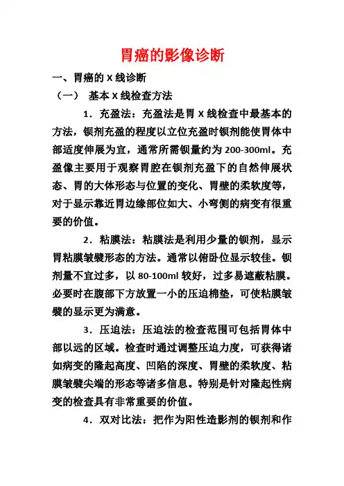 胃癌的影像诊断