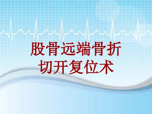 手术讲解模板：股骨远端骨折切开复位术
