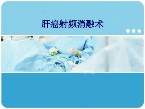 肝癌射频消融术PPT1