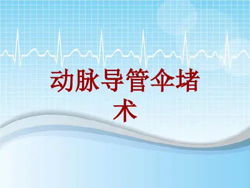 手术讲解模板：动脉导管伞堵术