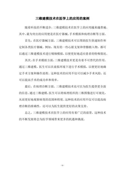 三维建模技术在医学上的应用的案例