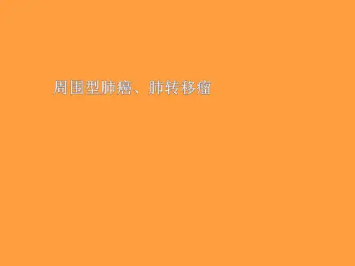周围型肺癌、肺转移瘤影像