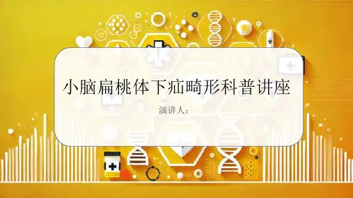小脑扁桃体下疝畸形科普讲座课件