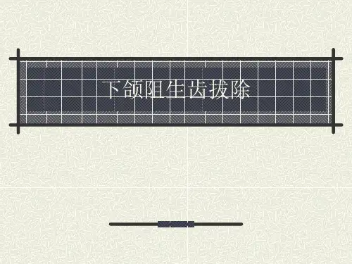下颌阻生齿拔除课件